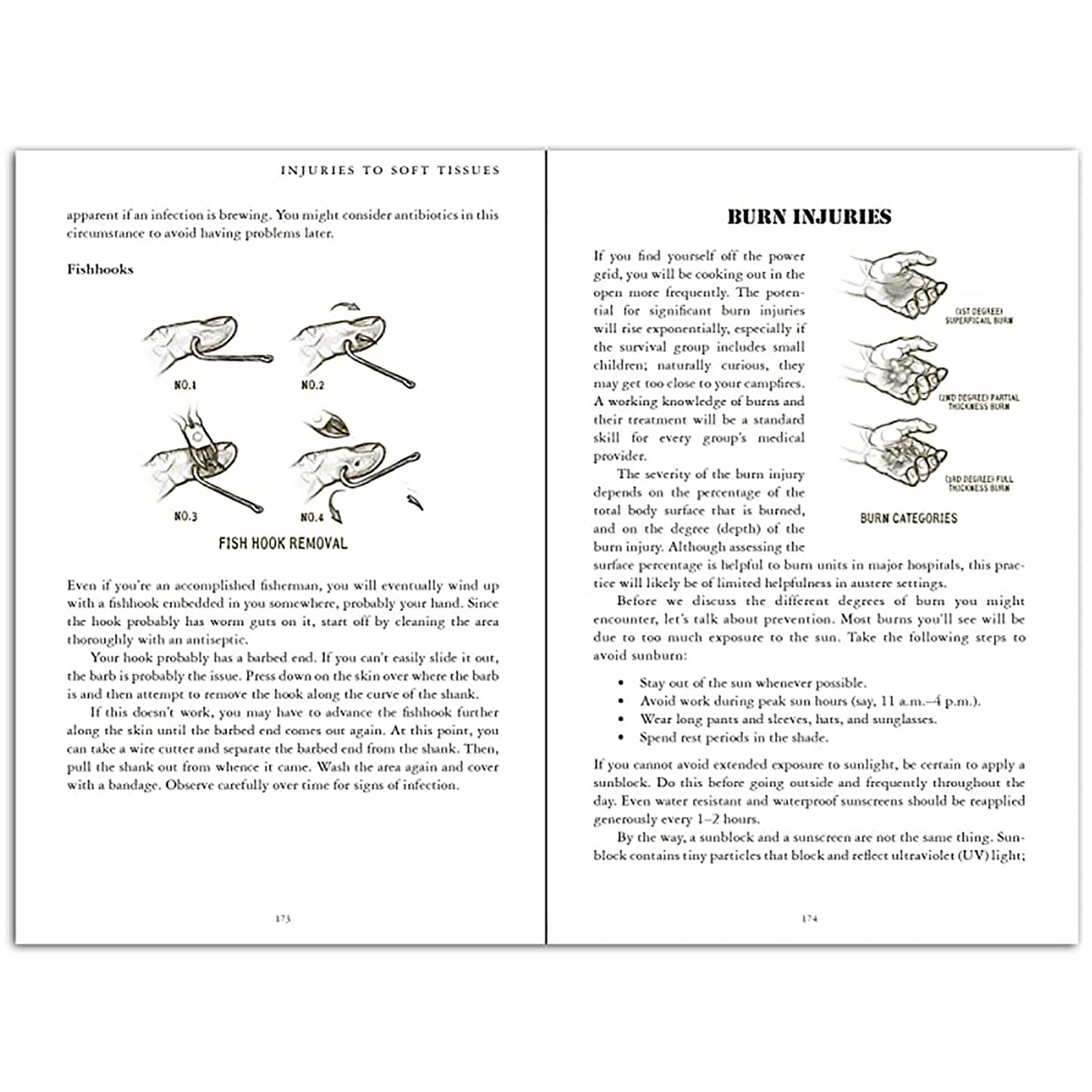 treating injuries in emergency